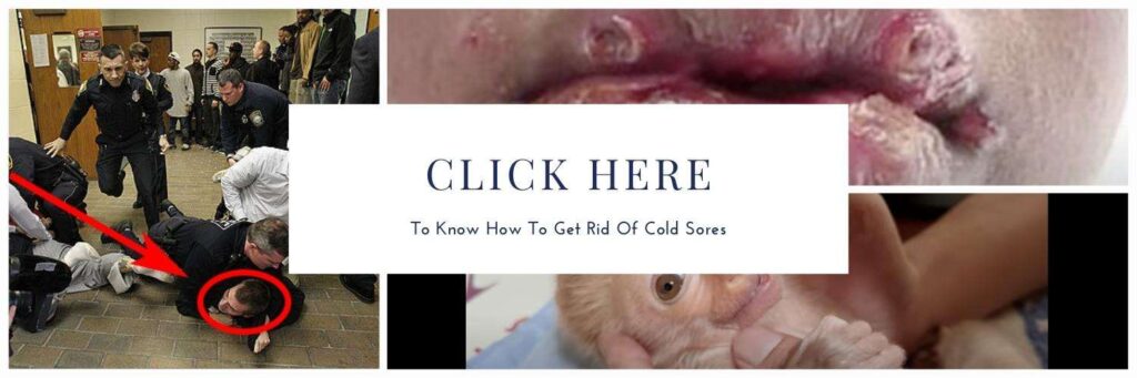 You care to know how to get rid of cold sore