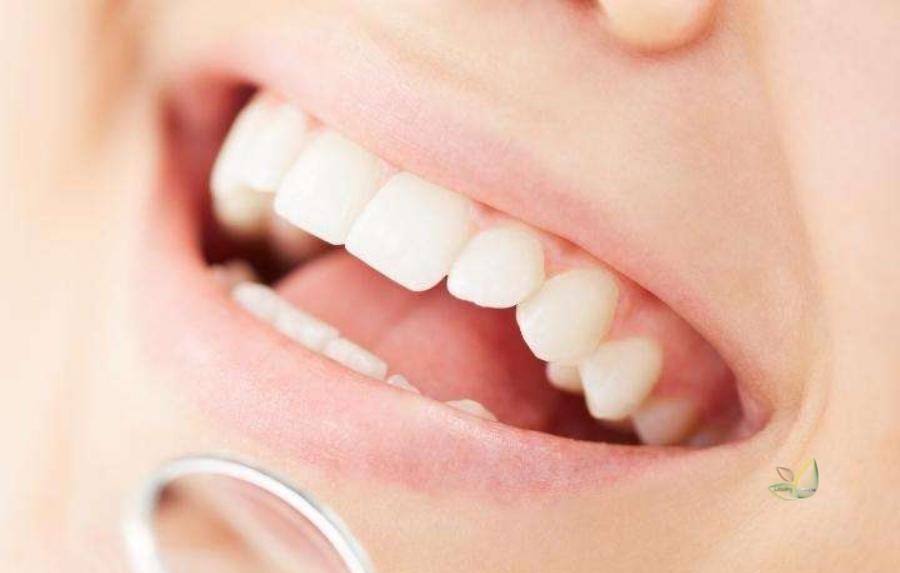 Maintain Your Perfect Smile | Leading lifestyle